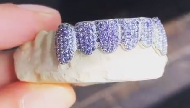 ג'סטין ביבר מציג שיניים משובצות יהלומים