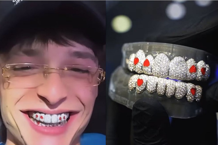 פסו פלומה מציג גשר יהלומים לשיניים